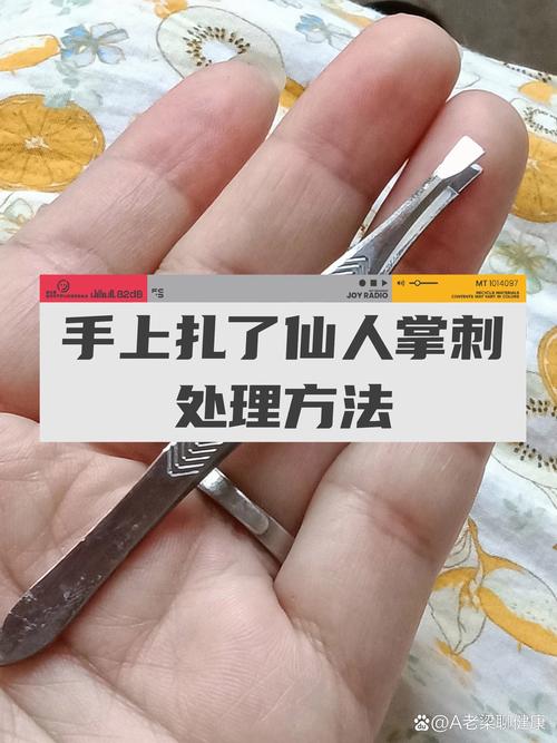 木刺、玻璃碎屑等异物的无菌取出技巧(木刺怎么去除)