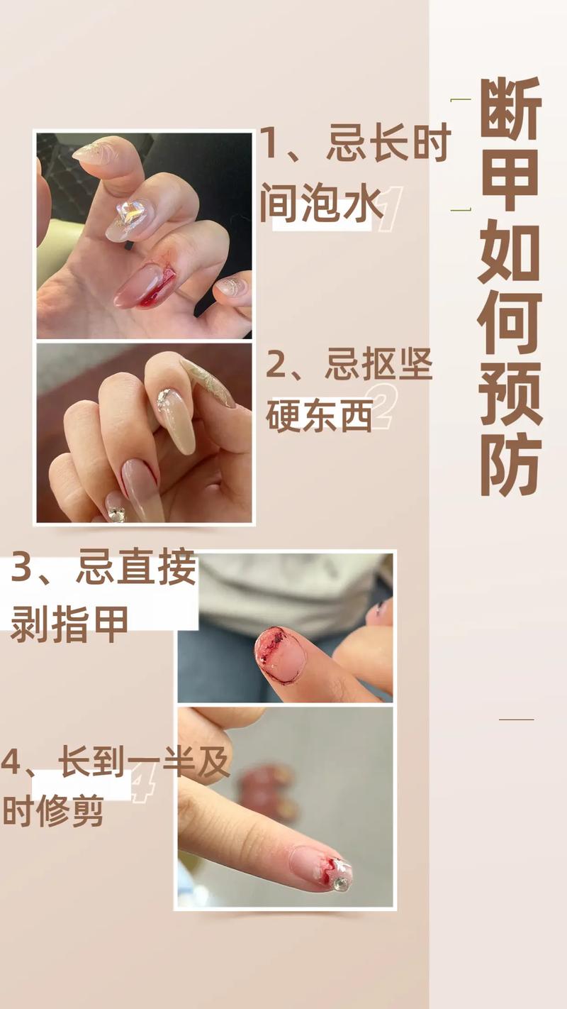 指甲受伤或脱落的紧急处置方法（指甲受伤脱落怎么治疗）
