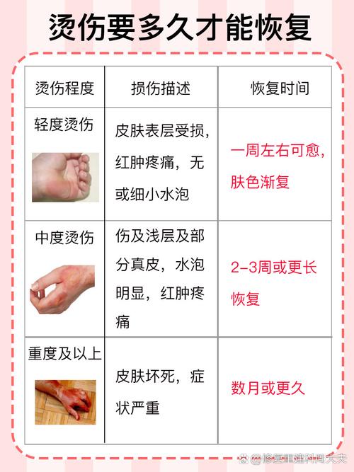 轻微烫伤的五个处理步骤（轻微烫伤该怎么办）